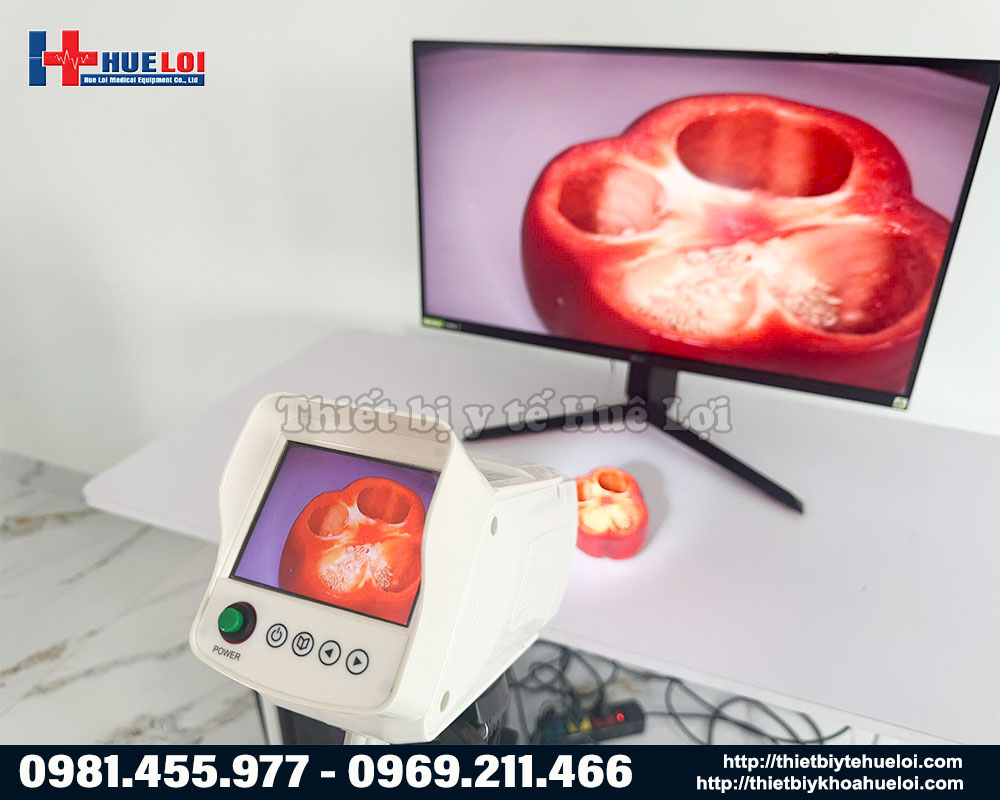 Máy soi cổ tử cung Full HD SW-304 Sanwe Medical